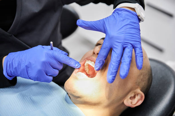 Best Chipped Tooth Repair Near Me  in Morse, LA